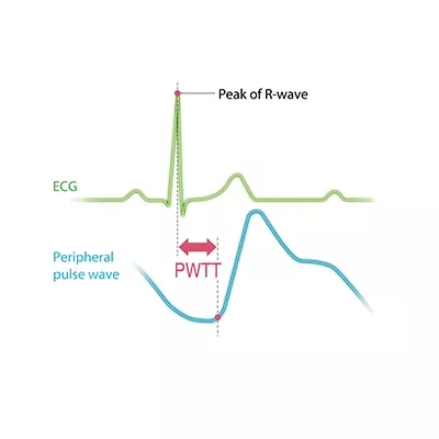 Technology PWTT sthumbnail image